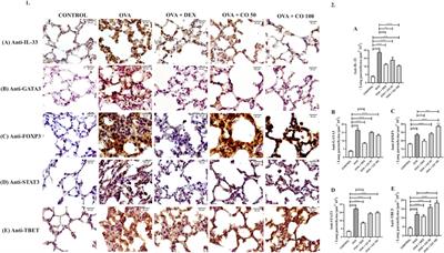 Copaiba oil minimizes inflammation and promotes parenchyma re-epithelization in acute allergic asthma model induced by ovalbumin in BALB/c mice